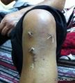 معلم يطالب وزيرالتربية بنقله من رنية لمحافظة الطائف لسوء حالته الصحية