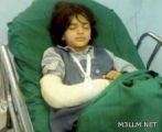 “الإهمال” يسقط طفلة من حافلة مدرسية